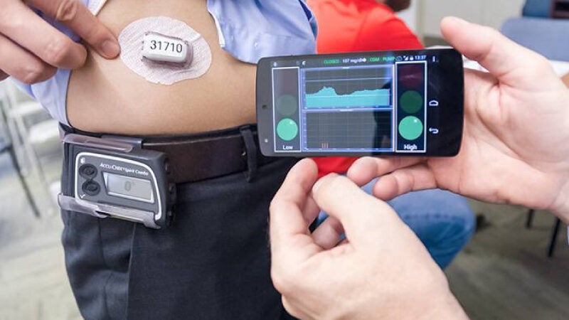 ‘Pâncreas artificial’ ajuda pacientes em tratamento da diabetes