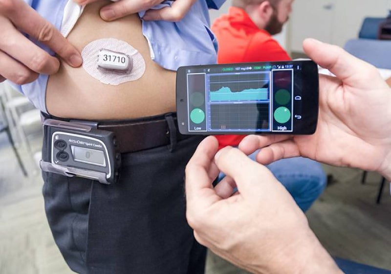 ‘Pâncreas artificial’ ajuda pacientes em tratamento da diabetes