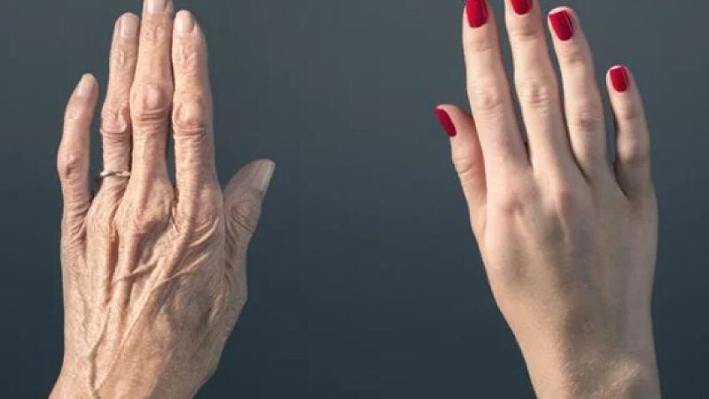 Cientistas rejuvenescem pele de mulher em 30 anos, diz estudo