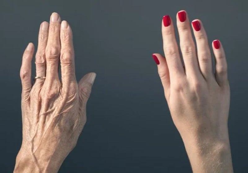 Cientistas rejuvenescem pele de mulher em 30 anos, diz estudo