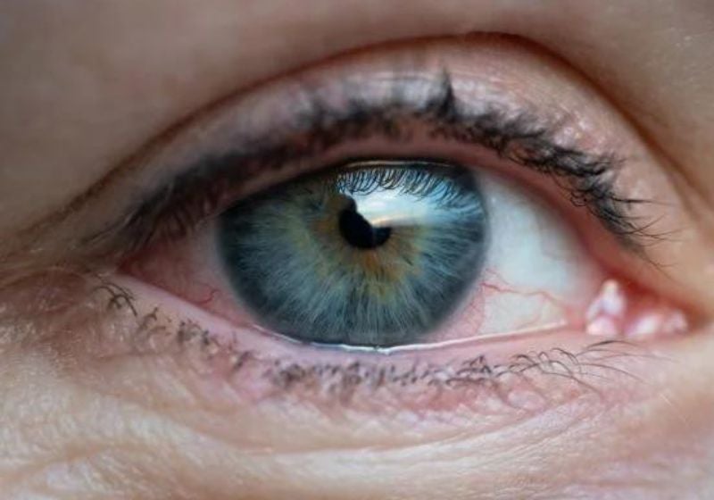 Cientistas criam aplicativo de celular que pode identificar Alzheimer e TDAH