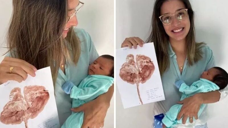 Enfermeira surpreende mamães com ‘árvore da vida’ feita da placenta em hospital