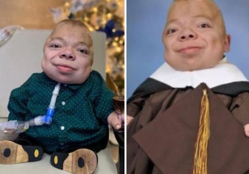 Rapaz com doença rara supera desafios e realiza sonho de ser jornalista