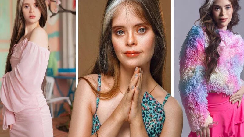 Modelo com down é destaque por beleza incomum e discurso de inclusão