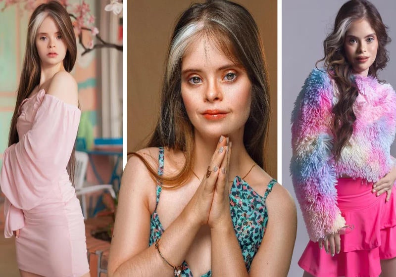 Modelo com down é destaque por beleza incomum e discurso de inclusão