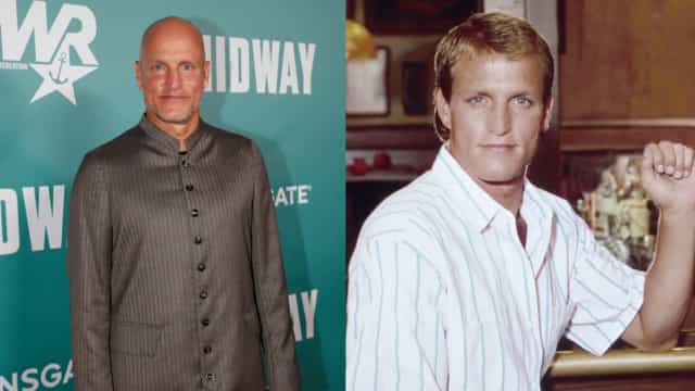 Carecas famosos quando eles tinham cabelo!