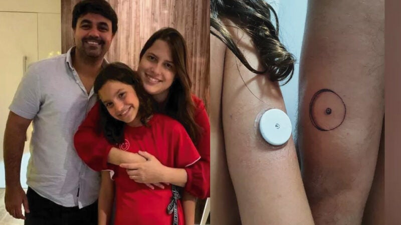 Pai tatua sensor de glicose para apoiar filha que usa o aparelho