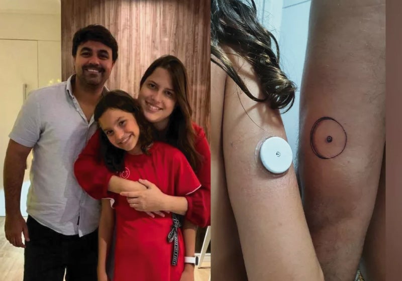Pai tatua sensor de glicose para apoiar filha que usa o aparelho