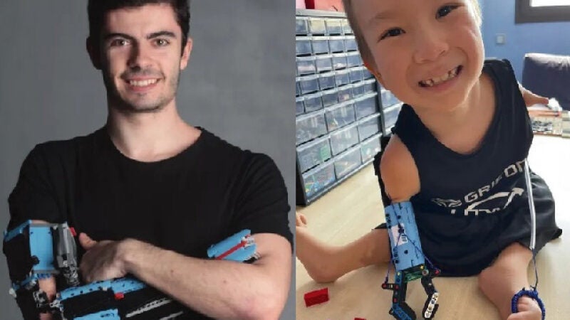 Jovem que nasceu sem parte do braço faz próteses de Lego e viraliza