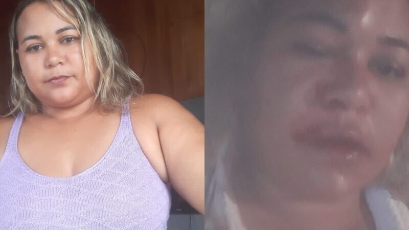 Em Guarantã do Norte mulher clamando por justiça após ter crânio trincado durante agressões do companheiro