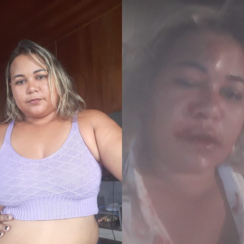 Em Guarantã do Norte mulher clamando por justiça após ter crânio trincado durante agressões do companheiro