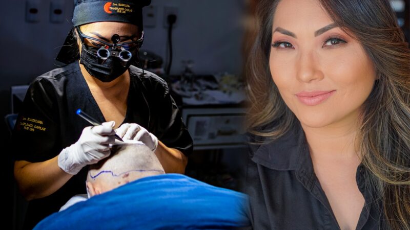 Médica de Sinop realiza técnica inovadora de transplante capilar