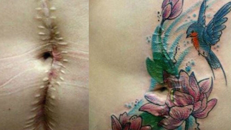 Mulher faz tatuagens gratuitas em vítimas de agressão doméstica