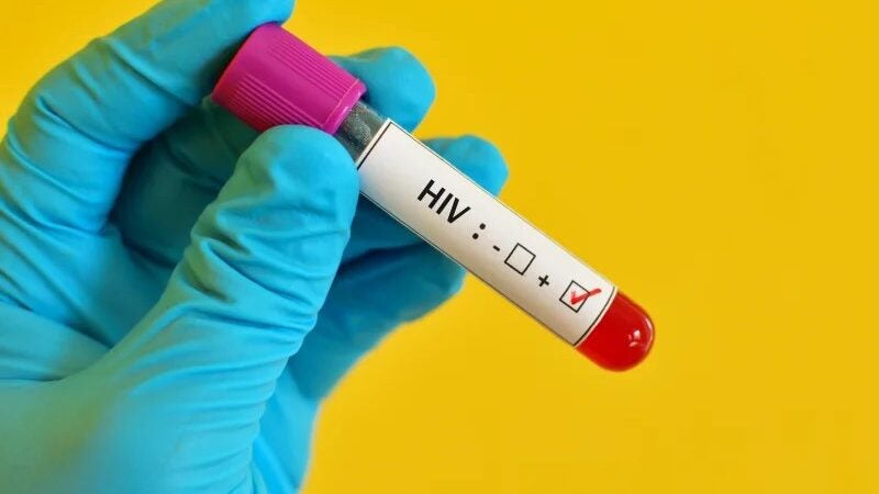 4º caso de cura do HIV no mundo recebeu transplante de medula