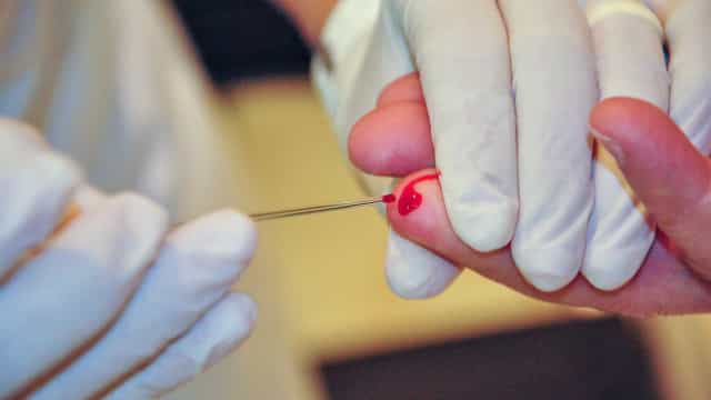 Ministério lança campanha contra hepatites virais; saiba como se prevenir