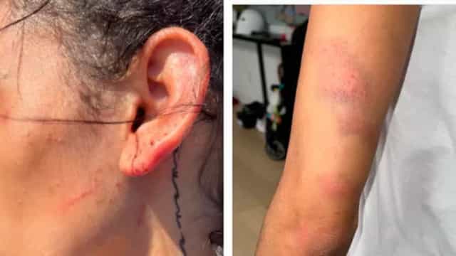 Esposa mostra lesões no corpo após alegar agressão de jogador da NBA
