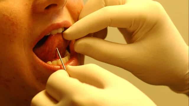 Hospital nega relação de morte de jovem com colocação de piercing