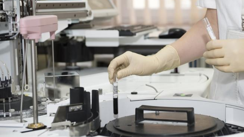 Ácido hialurônico ajuda a reparar tecido muscular lesionado, diz pesquisa