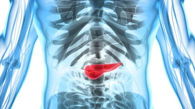 Câncer de pâncreas: cientistas brasileiros descobrem como frear a doença