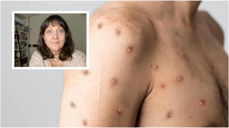 Infectologista reforça alerta da OMS e recomenda uso de máscaras