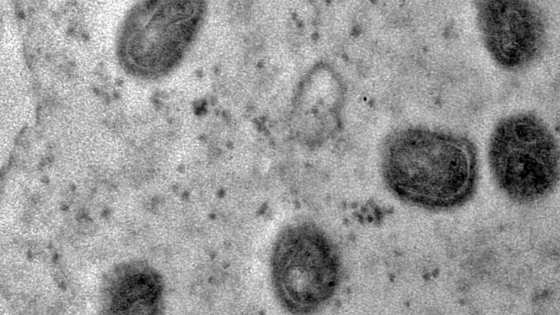 Fiocruz isola o vírus monkeypox e registra imagens da estrutura detalhada
