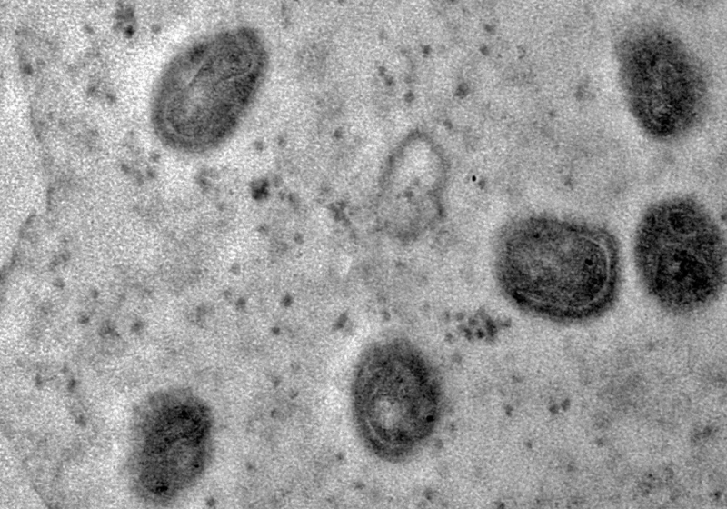 Fiocruz isola o vírus monkeypox e registra imagens da estrutura detalhada