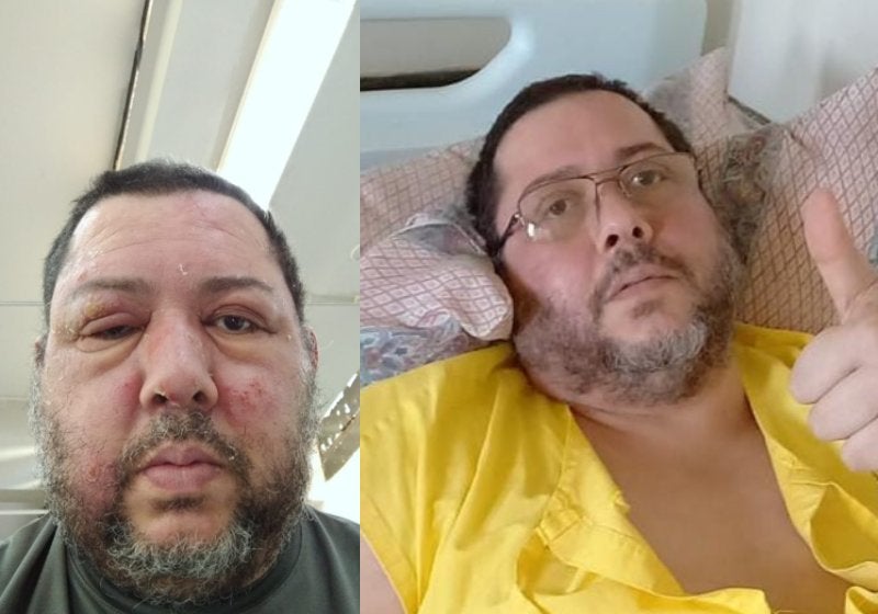 “O hospital público salvou minha vida”, diz brasiliense paralisado após quadro infeccioso grave
