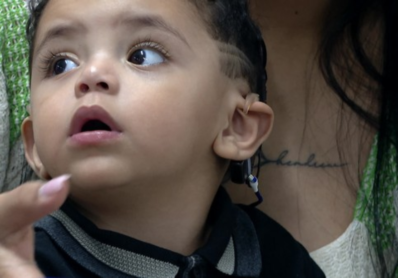 Implante faz menino que nasceu com surdez profunda ouvir pela 1ª vez