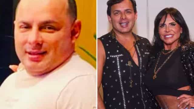 Marido de Gretchen surpreende ao mostrar antes e depois da harmonização facial