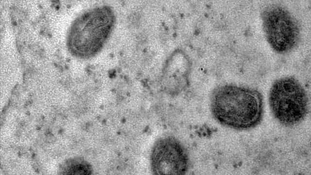 Fiocruz registra imagens de replicação do vírus monkeypox em célula