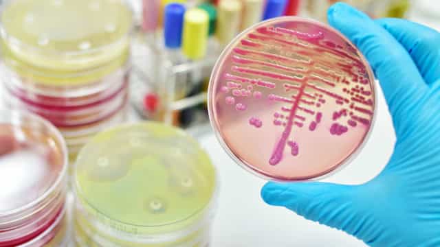 Avanço de casos e mortes por meningite acende alerta no Estado de São Paulo