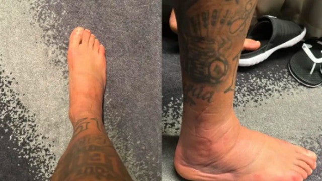 Fora da fase de grupos da Copa, Neymar mostra tornozelo inchado