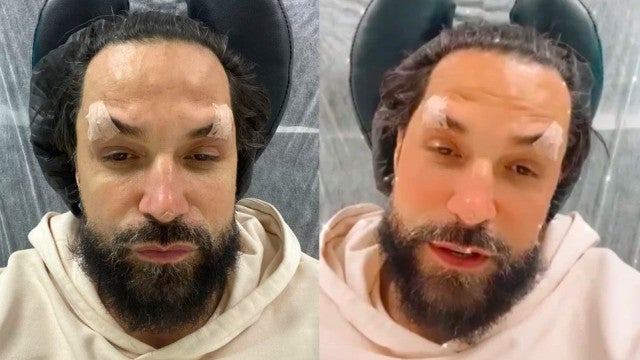 Latino desabafa após ser comparado a Diabo por rejuvenescimento facial
