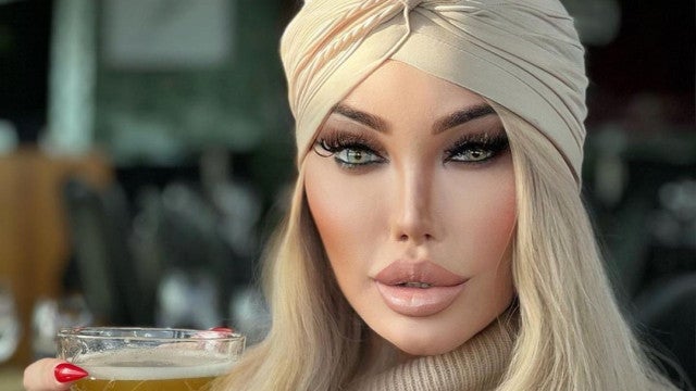 Jessica, ex-Ken Humano, é operada após problema com silicone nas nádegas