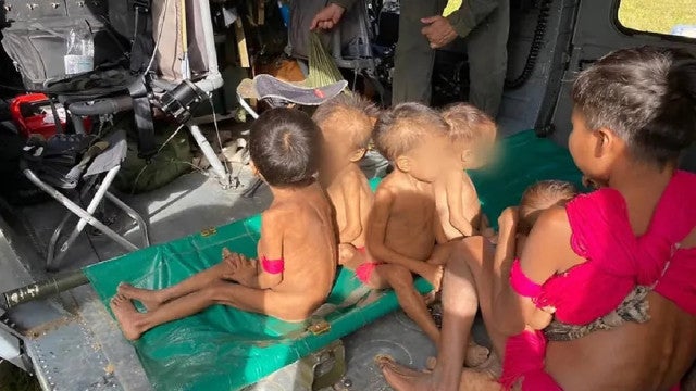 Crianças yanomamis são intubadas em UTI de Boa Vista com desnutrição grave e longe dos pais