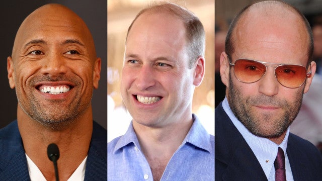 É dos carecas que elas gostam mais? Os famosos calvos mais gatos!