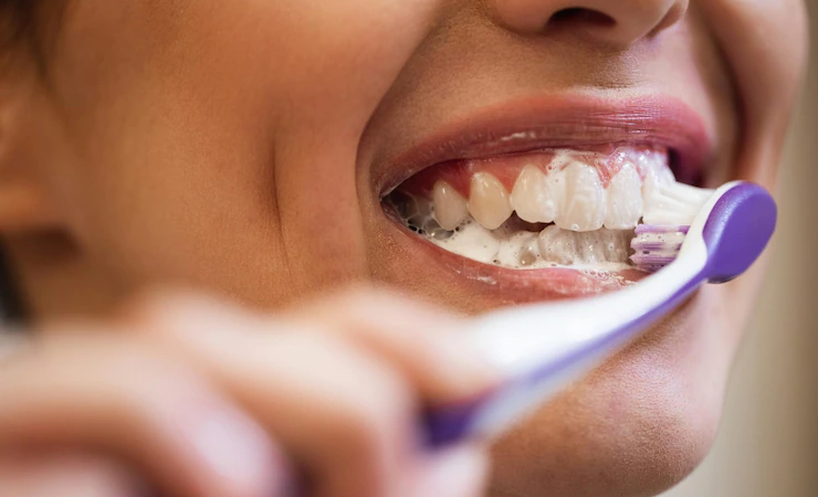 Cirurgiã dentista fala sobre 6 hábitos que causam malefícios para os dentes