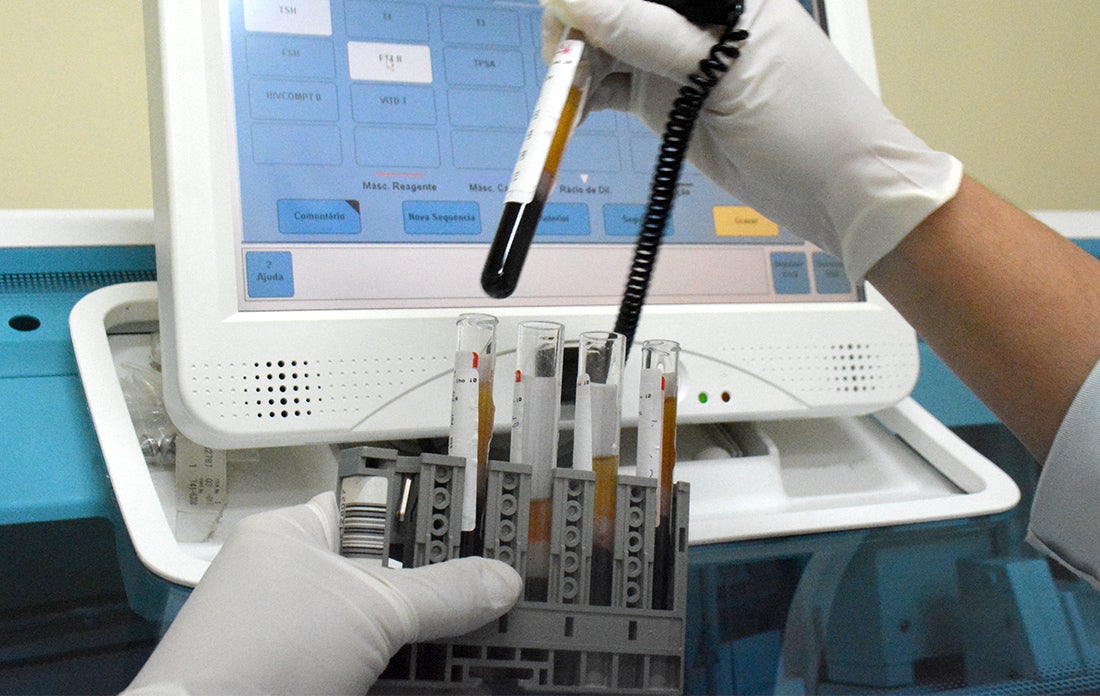 Prefeitura de Guarantã do Norte definirá empresa para prestar mais de 15 mil exames laboratoriais