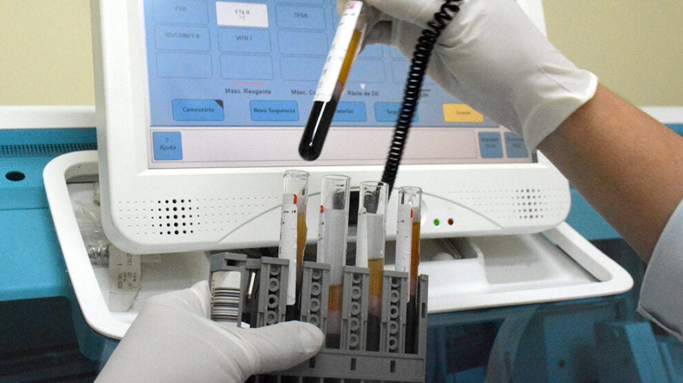 Prefeitura de Guarantã do Norte definirá empresa para prestar mais de 15 mil exames laboratoriais
