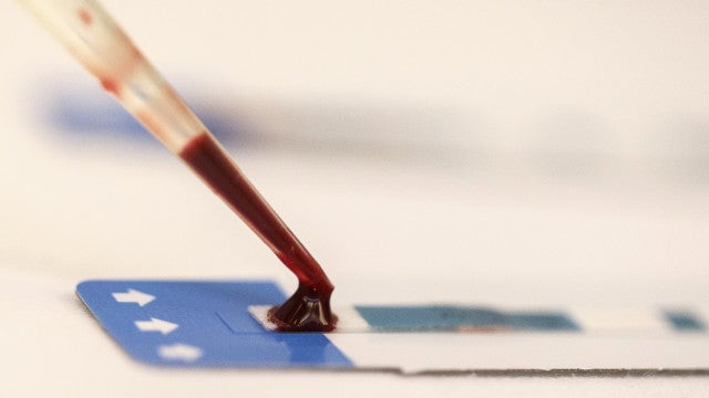 Líderes fazem pacto para acabar com Aids em crianças até 2030