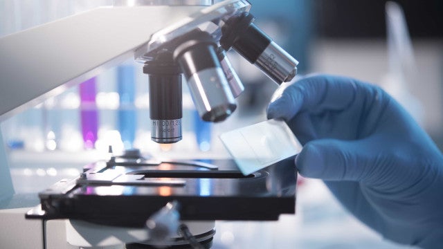 Metade das crianças com síndrome do zika não frequenta escola no Rio