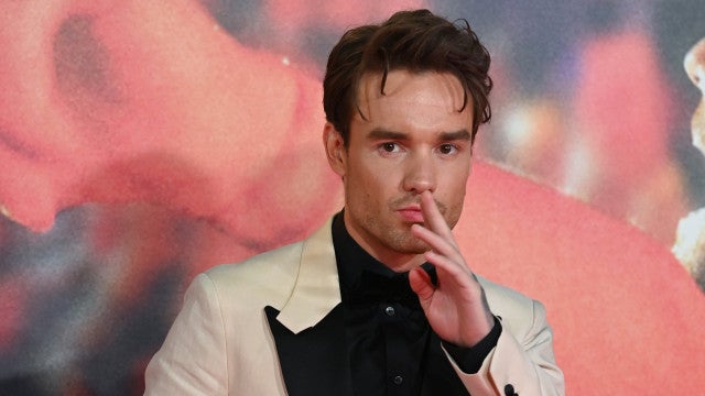 Fãs em alerta após mudanças radicais no rosto de Liam Payne