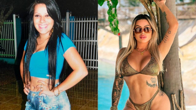 Após R$ 300 mil em plásticas, modelo Jéssica Juliane encara 16ª cirurgia
