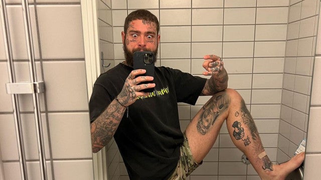 Post Malone nega uso de drogas após repentina perda de peso