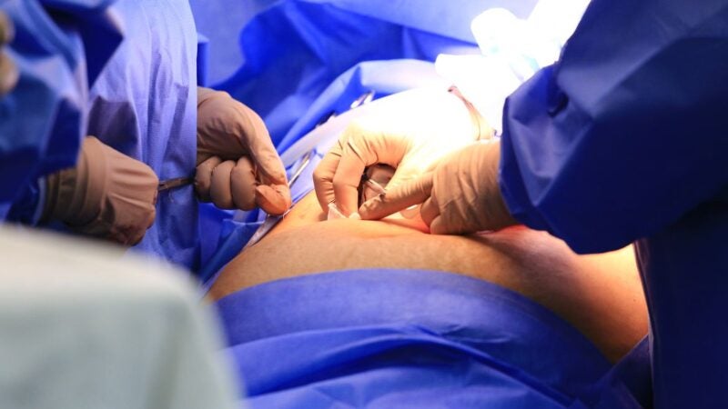 Mais de 679 mil pessoas no Brasil aguardam em filas de cirurgias eletivas