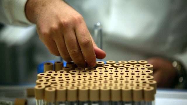 Mãe faz teste de DNA e descobre que está criando filho de outro pai