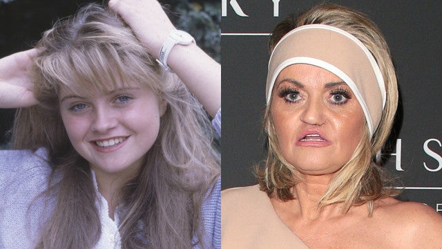 Atriz com rosto corroído por cocaína fará cirurgia para evitar morte