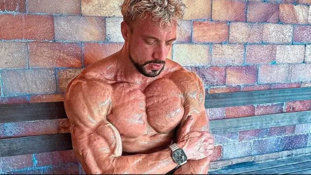 Fisiculturista morre aos 30 anos vítima de aneurisma; ele tinha doença rara