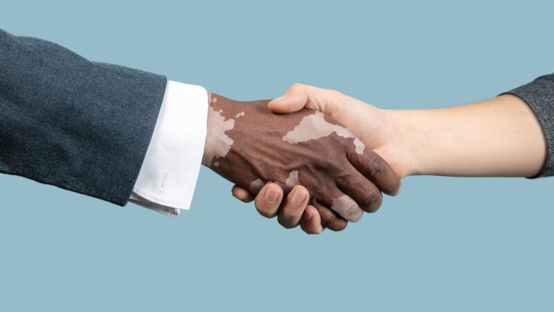 Especialistas da Rede Ebserh e pessoas que convivem com a doença desmistificam o vitiligo