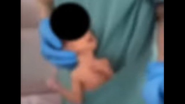 Fisioterapeuta é suspensa após ‘dançar’ com bebê no bolso do uniforme